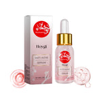 Hoygi Anti-Acne Serum with packaging on a white background